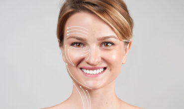 Face Lift